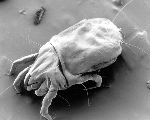 Dermatophagoides pteronyssinus תחת מיקרוסקופ אלקטרונים