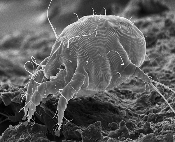 Let's talk about ear mites and the otodectosis they cause in humans and pets...