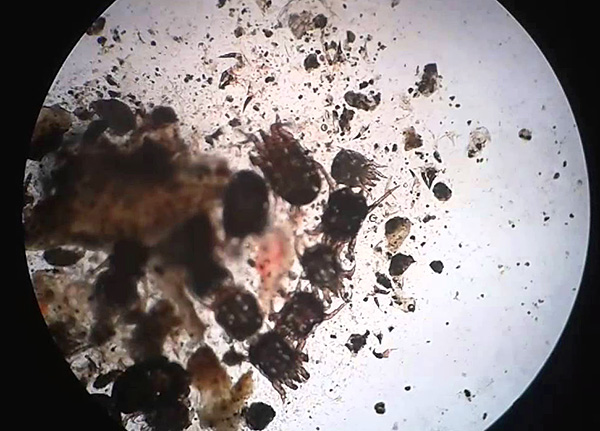 Ear mites in an animal ear discharge sample.
