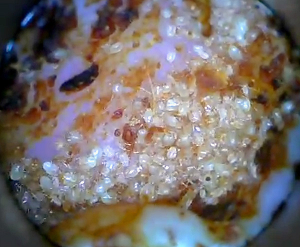 The massive accumulation of parasites in the ear canal is clearly visible.