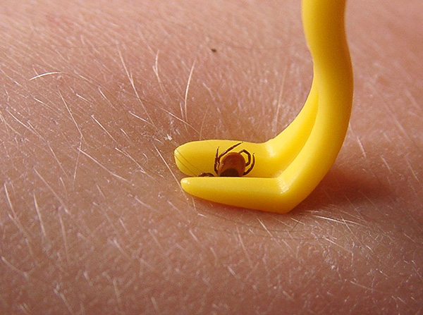 O princípio de funcionamento da maioria dos dispositivos para remover carrapatos envolve torcer suavemente o parasita da pele.