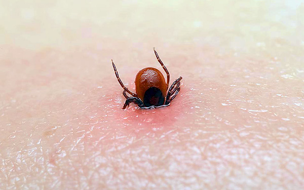 Včasné očkovanie proti TBE je kľúčom k spoľahlivej ochrane pred vážnymi následkami prisatia kliešťa.