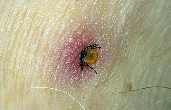 A estrutura especial do aparelho bucal dos carrapatos ixodídeos permite que eles sejam mantidos com muita firmeza na pele do hospedeiro após uma picada.