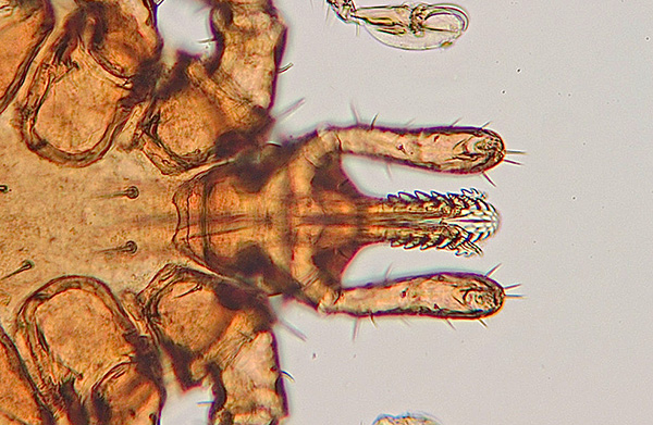 Órgãos da boca de um carrapato sob um microscópio