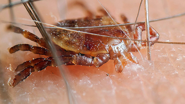 L'infection n'est possible qu'avec la piqûre d'un parasite, et si elle vient de ramper à travers la peau, elle est sans danger.