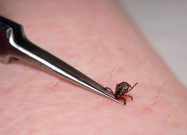 Čím rýchlejšie sa prichytený parazit odstráni, tým menej infikovaných slín stihne vpichnúť pod kožu.