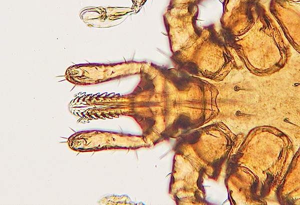 L'appareil buccal du parasite est capable de tenir très solidement dans la peau de la victime.