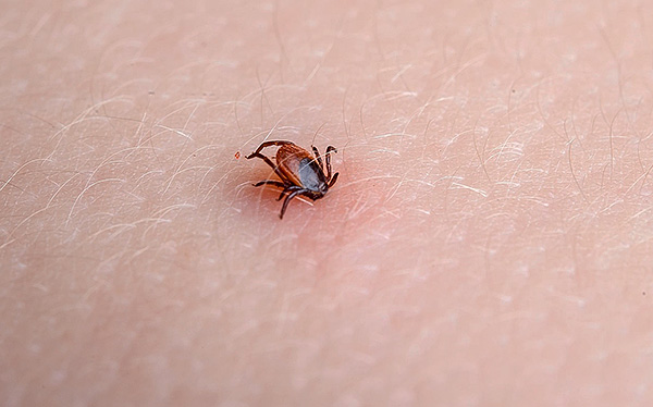 การติดเชื้อ borreliosis ที่เกิดจากเห็บจะเกิดขึ้นเฉพาะกับเห็บกัดเท่านั้น แต่เป็นไปไม่ได้ที่จะติดเชื้อจากบุคคลอื่นที่เป็นโรคนี้