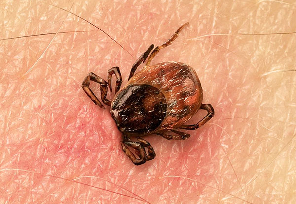 Tick ​​suction as a type of insured event