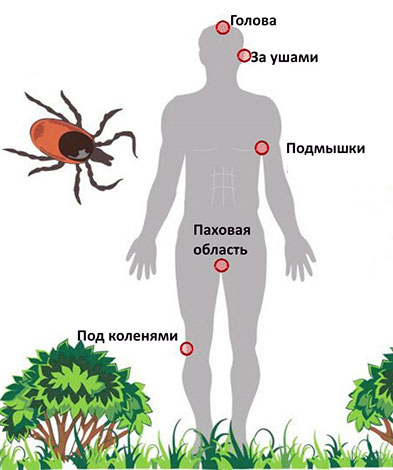 Locais das picadas de carrapatos mais frequentes no corpo humano