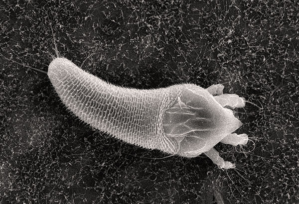 Spines on the body of a kidney tick
