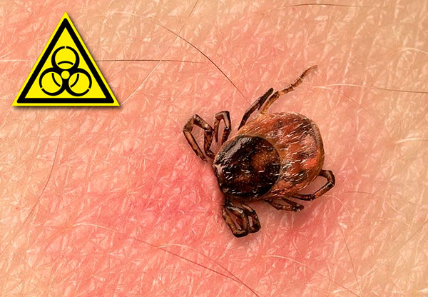 Consideriamo in dettaglio le infezioni portate dalle zecche: metodi di trasmissione, caratteristiche del decorso della malattia e metodi efficaci di trattamento ...