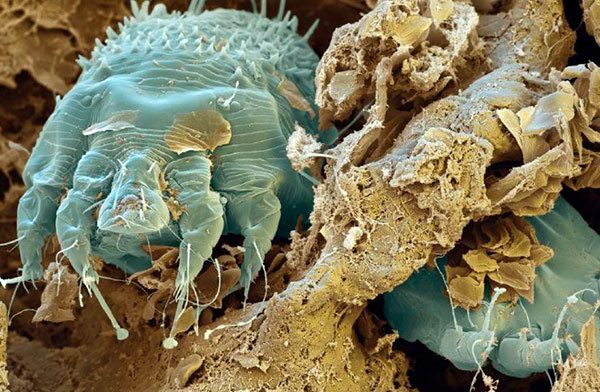 Acari della scabbia al microscopio